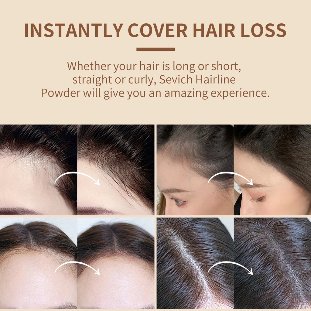 SEVICH Hairline Shadow Powder with Brush, Water- and Sweat-Resistant Hair Loss Concealer, Bald Spot Cover-Up Powder for Women and Men