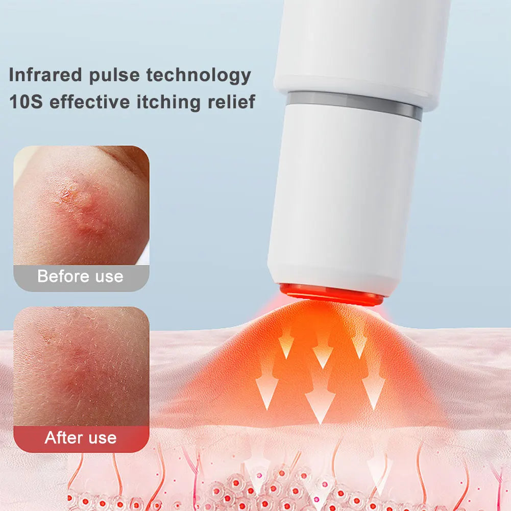 Portable Mosquito Insect Bite Relieve Itching Pen Electric Insect Bite Healer for Adult Children Camping Travel Outdoor Sports